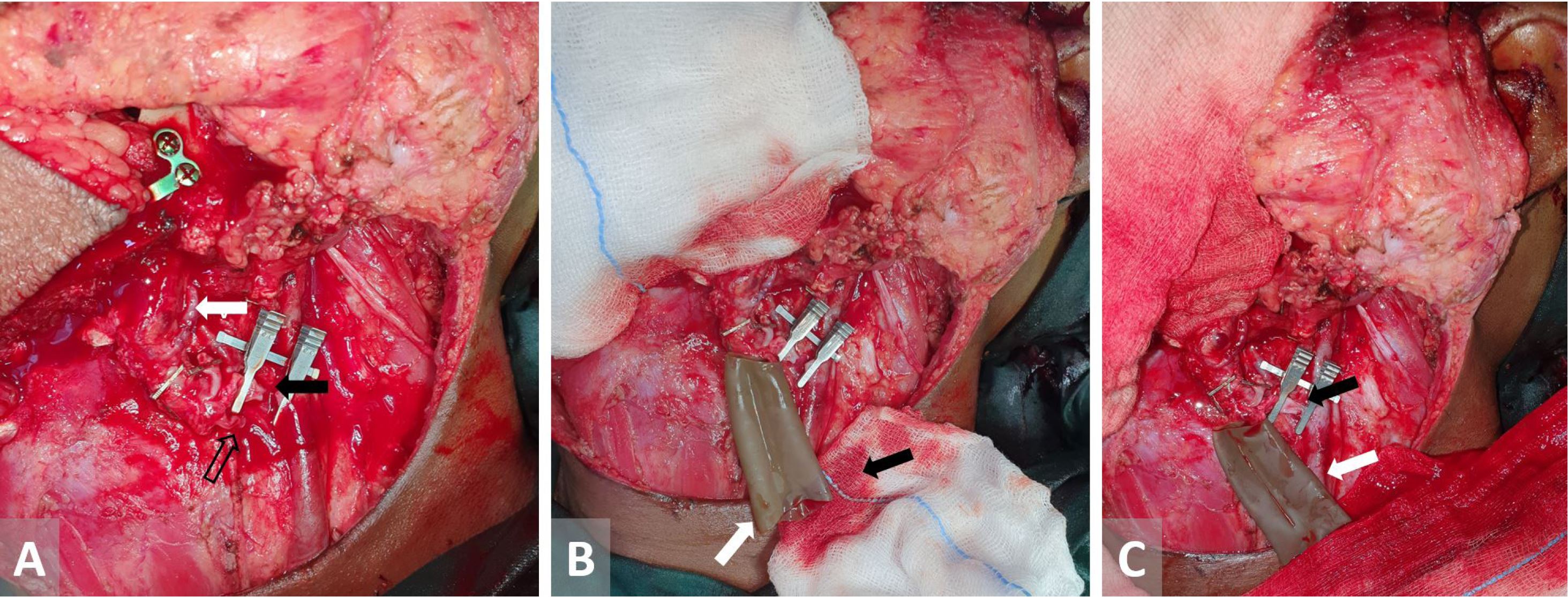 Figure 1.JPG